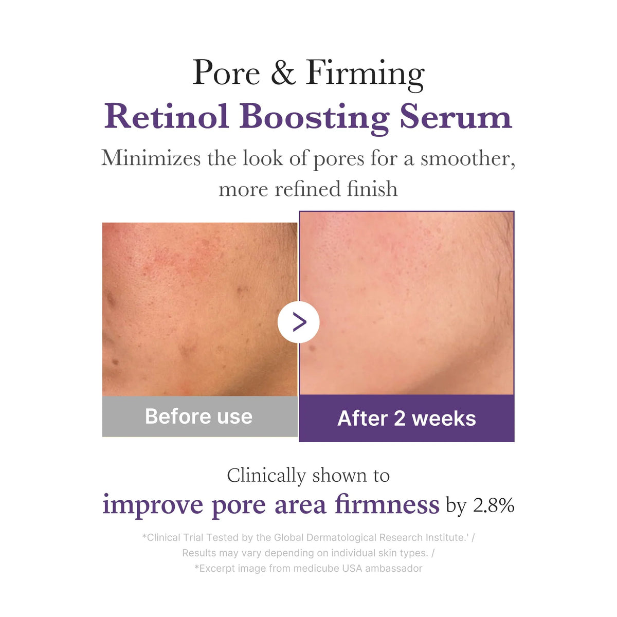 MEDICUBE - Retinol NMN Boosting Serum - 30ml Contra envejecimiento y manchas