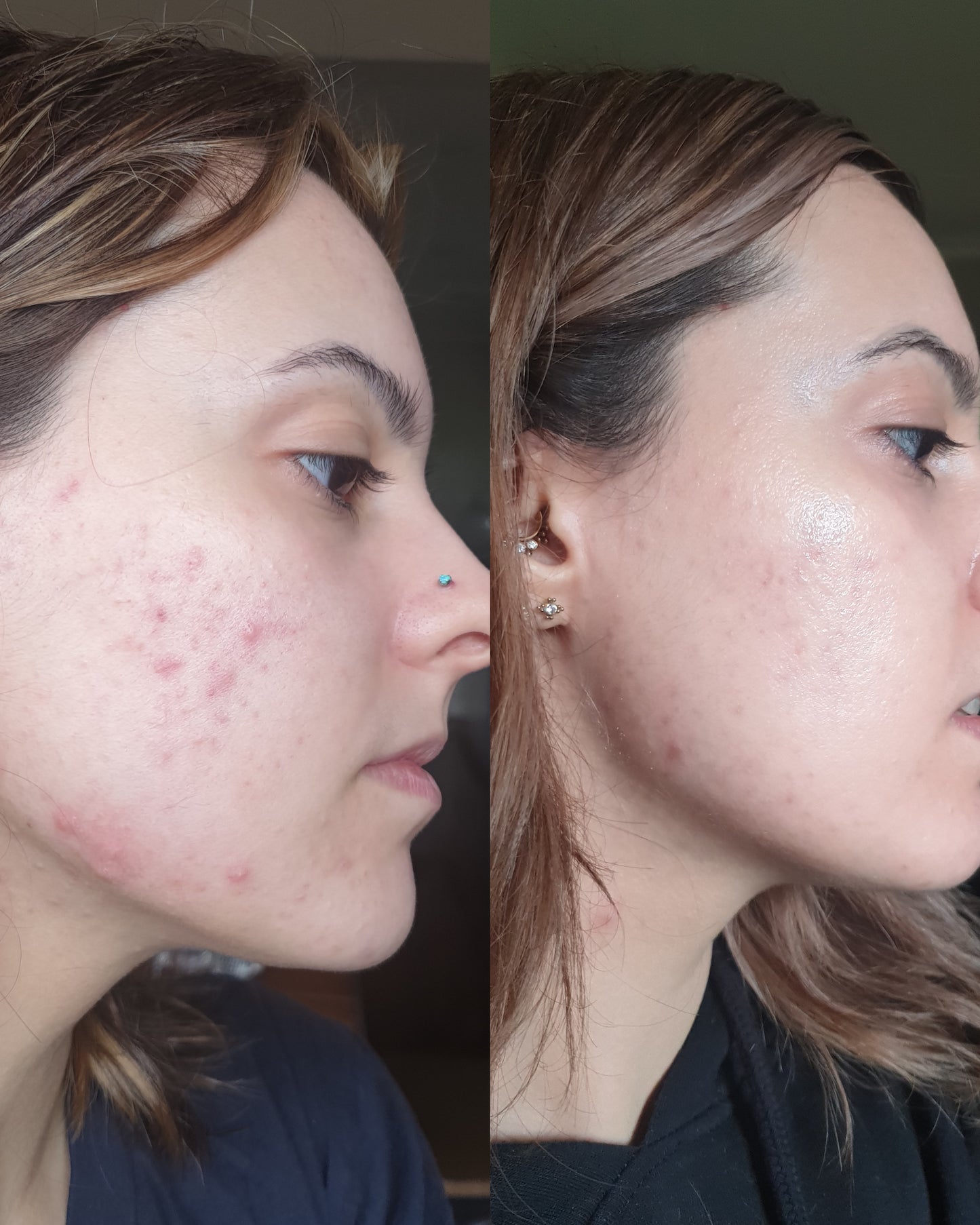 COSRX GALACTOMYCES 95 TONE BALANCING ESSENCE - Esencia con ácido hialurónico antiedad y antimanchas